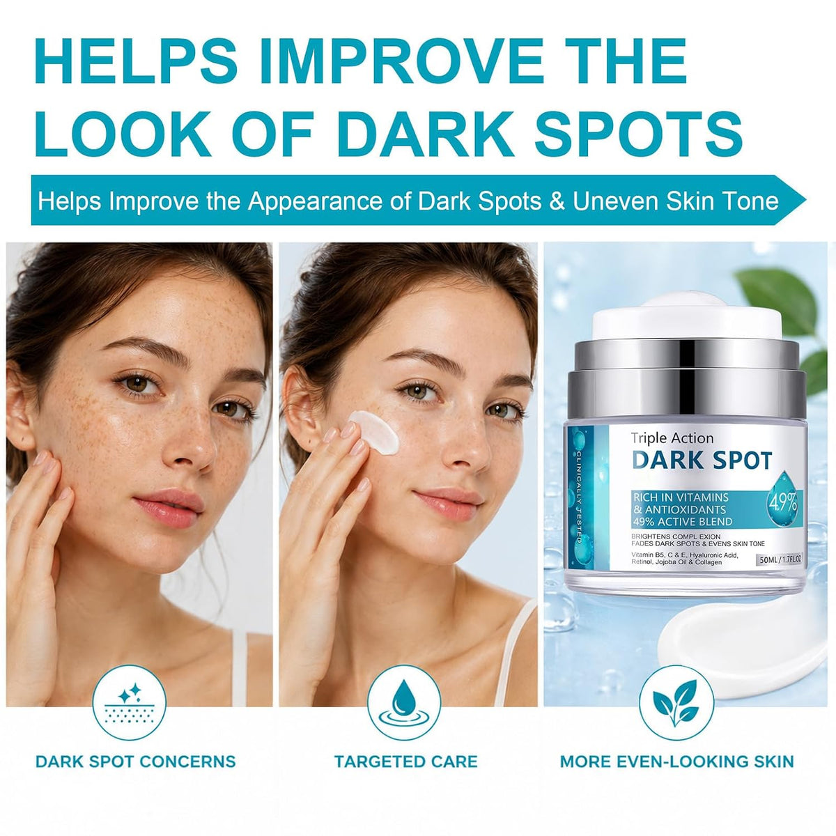 Dark Spot Corrector Cream for Face and Body, Dark Spot Corrector Cream Reduce the Appearance of Dark Spots for Age Spot, Blemish Spot, Freckle, Sun Spots & Blemish for Women Men